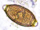 Trichuris