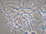 Actinomicetos nocardioformes